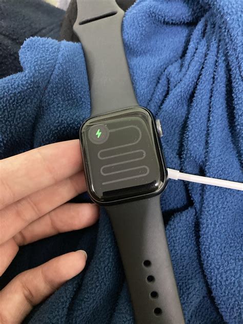 why does my apple watch smell sour